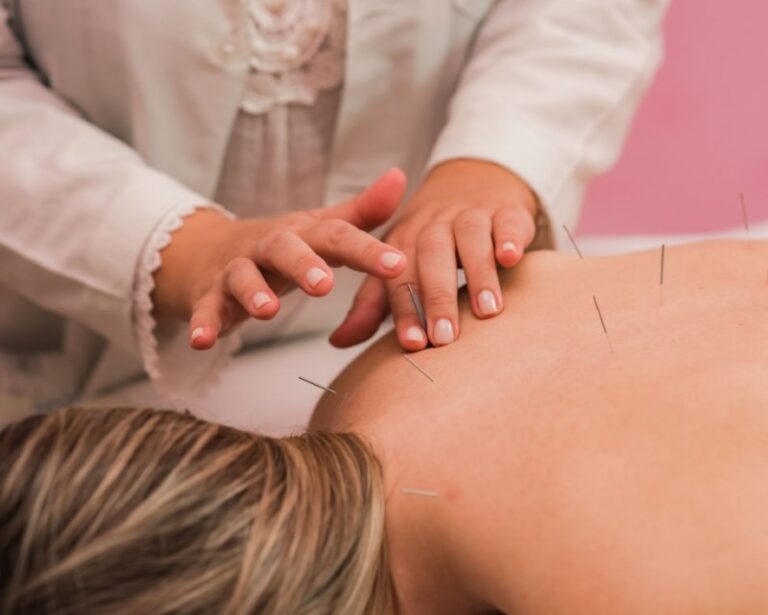 acupuntura
