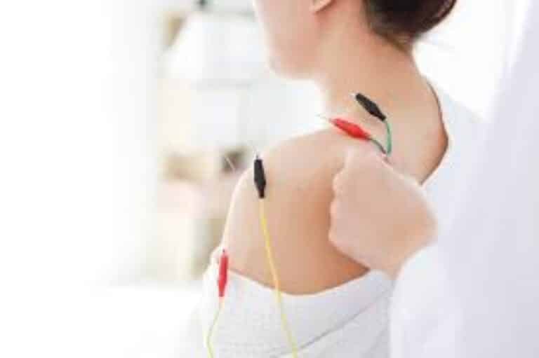 acupuntura neurofuncional