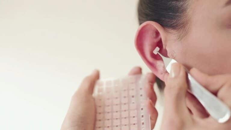 auriculoterapia